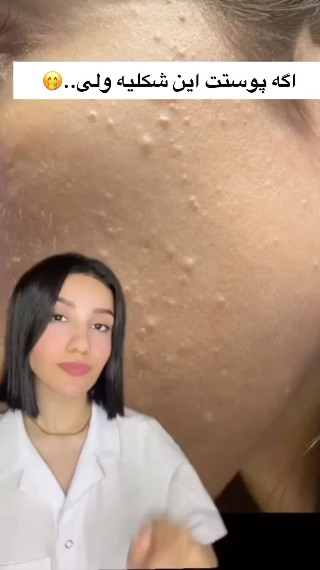 ژل ضدجوش دیفرین