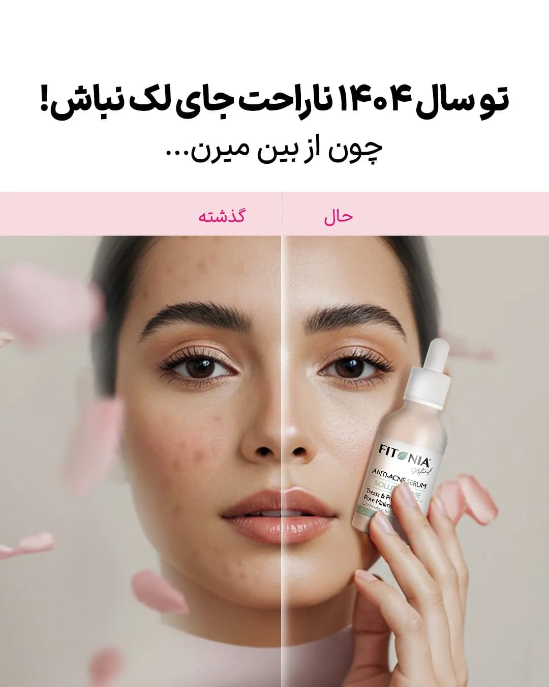 سرم ضدجوش فیتونیا، رنگ کرم و سفید، جنس شیشه، بطری با قطرهچکان