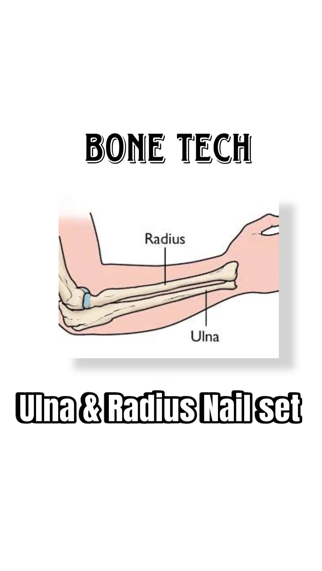 ست نیل اولنا و رادیوس ارتوپدی Bone Tech