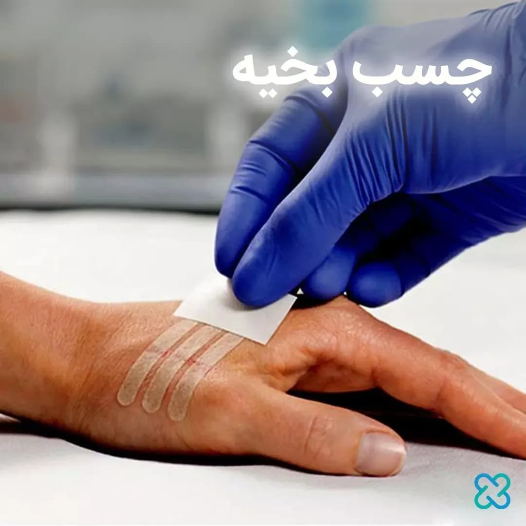 چسب بخیه، رنگ سفید و کرم، نواری