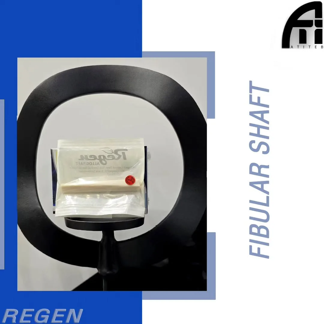 آلوگرفت استخوان فیبولار، رنگ کرم، مدل Shaft، استوانه‌ای