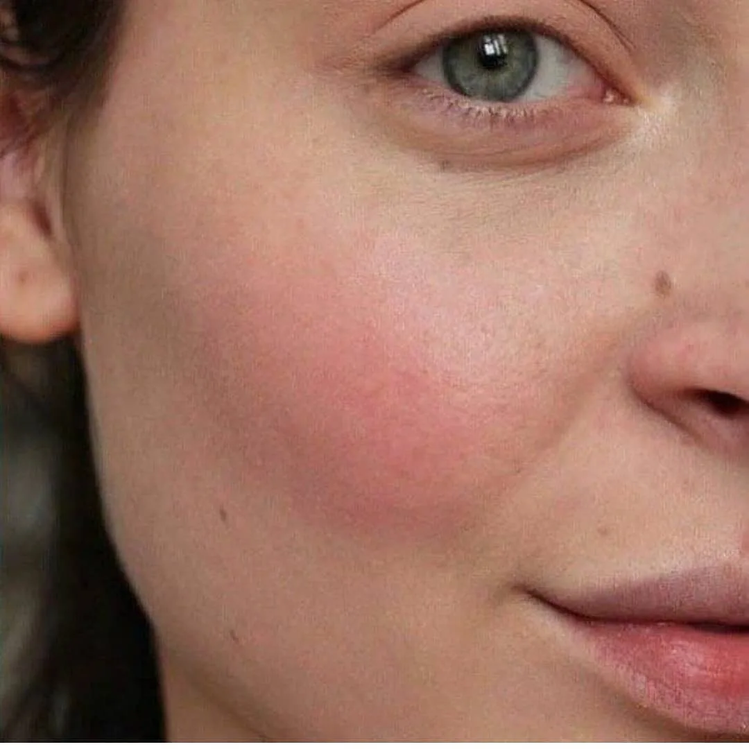 تینت لب و گونه بنه‌تینت — عکس ۵