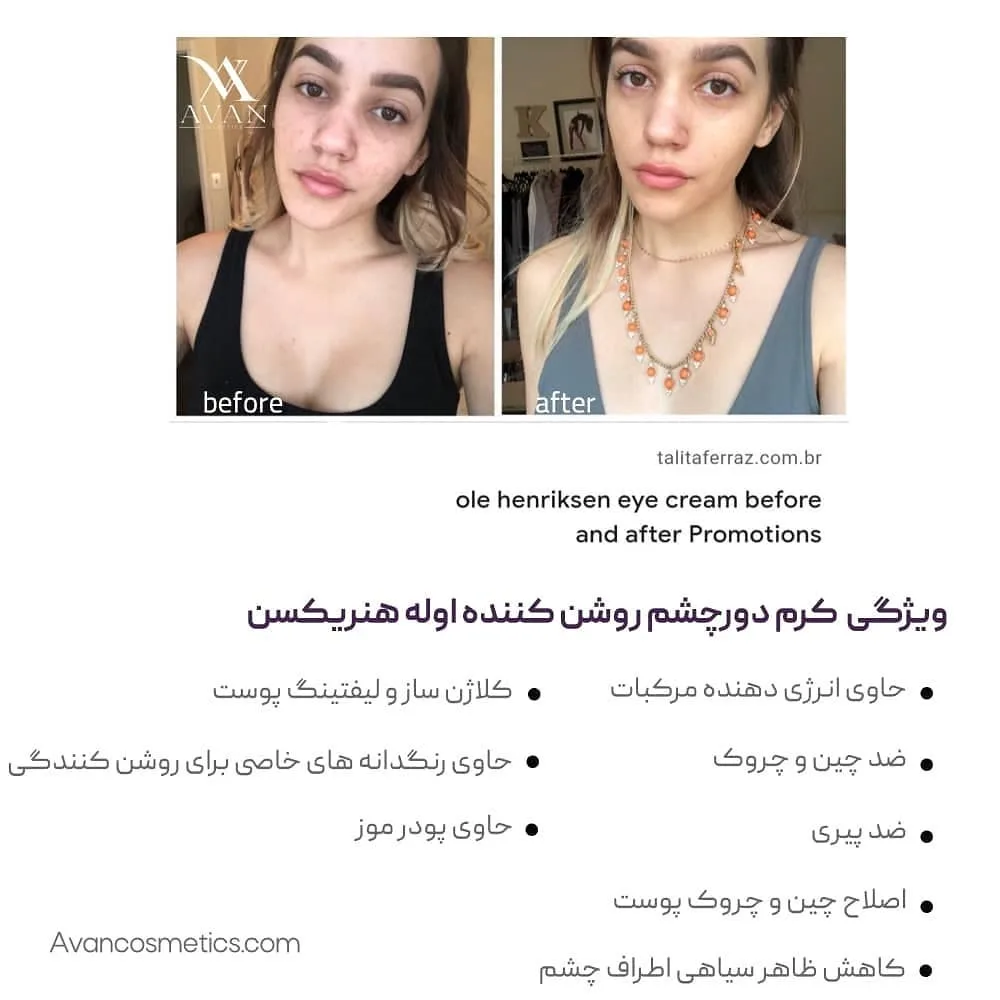 کرم دور چشم بنانا برایت — عکس ۲