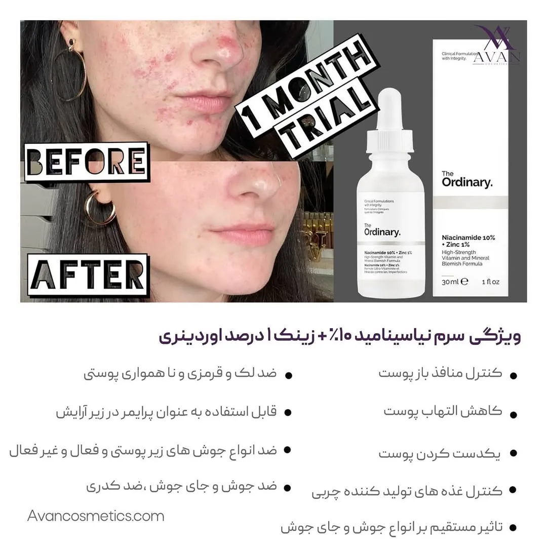 سرم نیاسینامید ۱۰٪ و زینک — عکس ۲