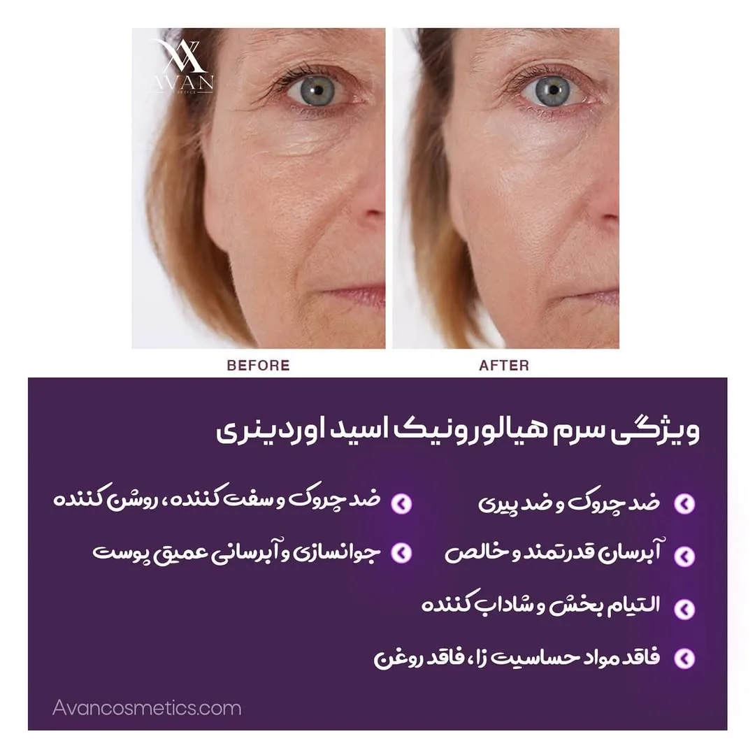 سرم هیالورونیک اسید — عکس ۲