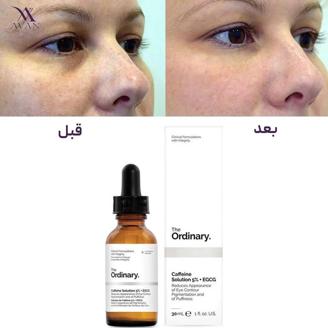 سرم کافئین — عکس ۴