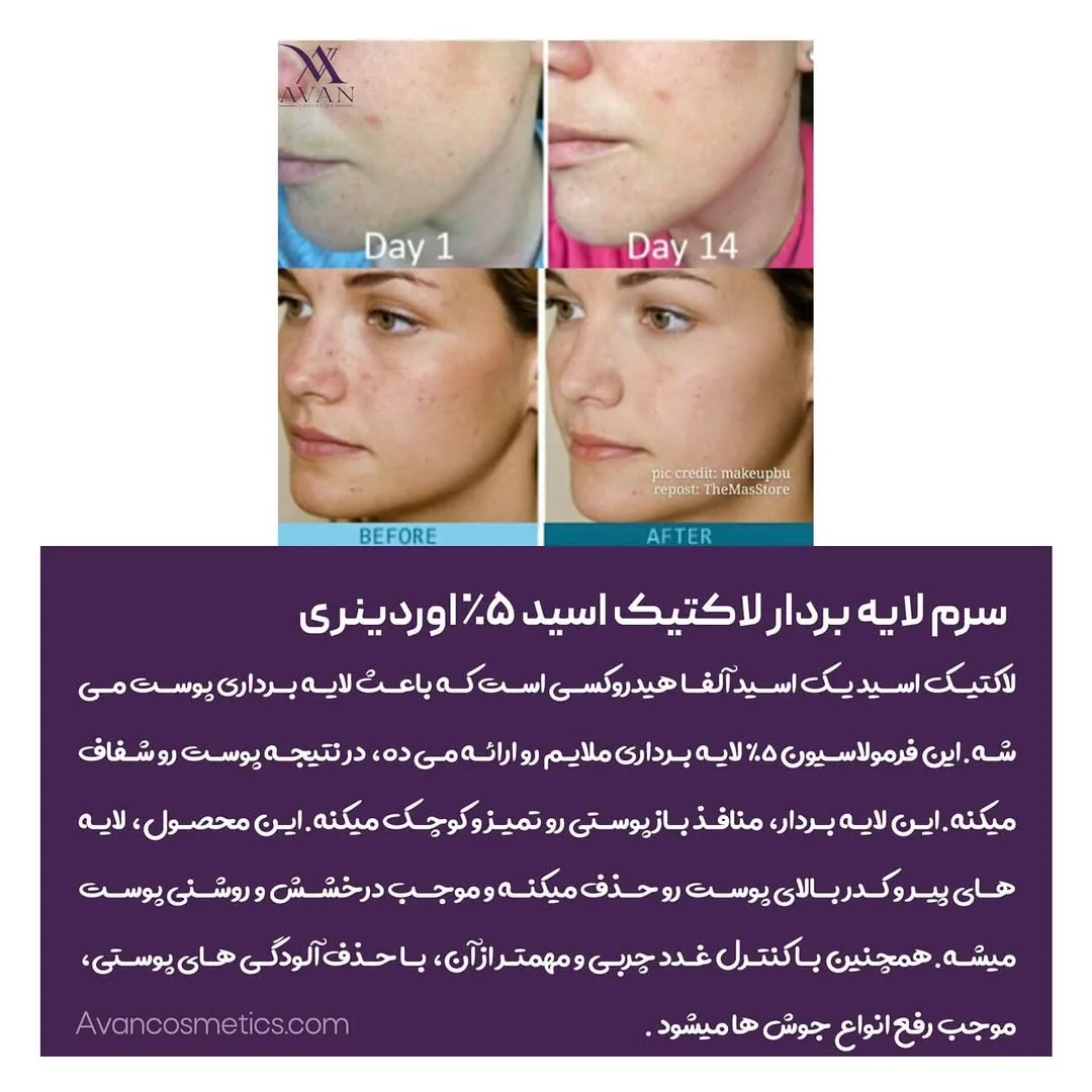 سرم لایه‌بردار لاکتیک اسید ۵٪ — عکس ۴