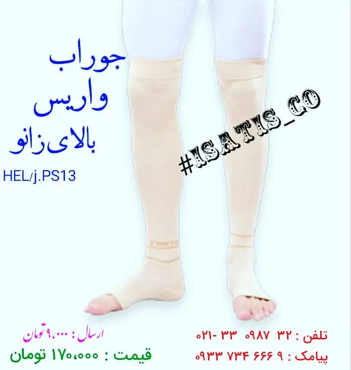 جوراب واریس بالای زانو، رنگ کرم، جنس بافتنی، جوراب طبی