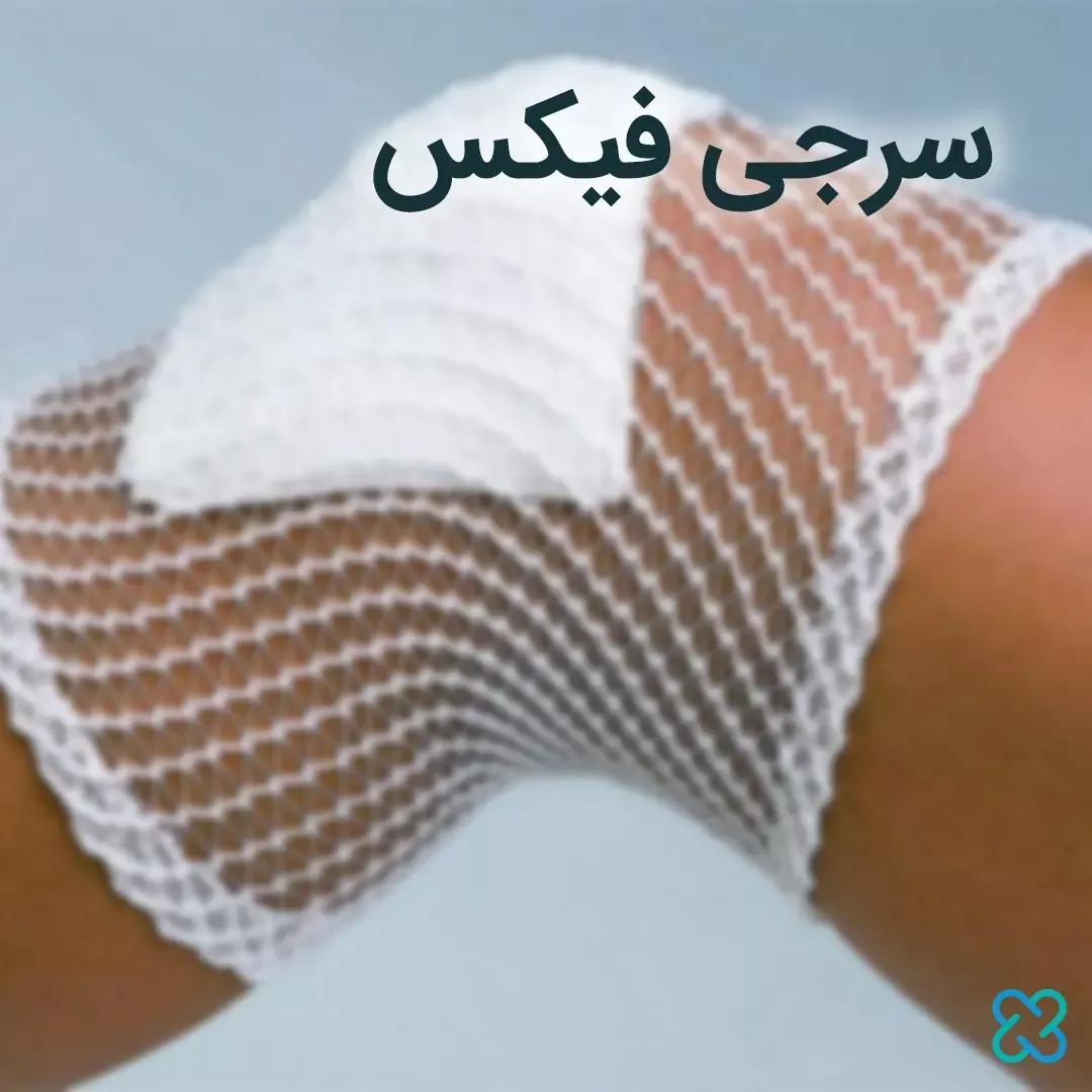 سرجی فیکس نگهدارنده پانسمان، رنگ سفید، طرح توری، توری کشی
