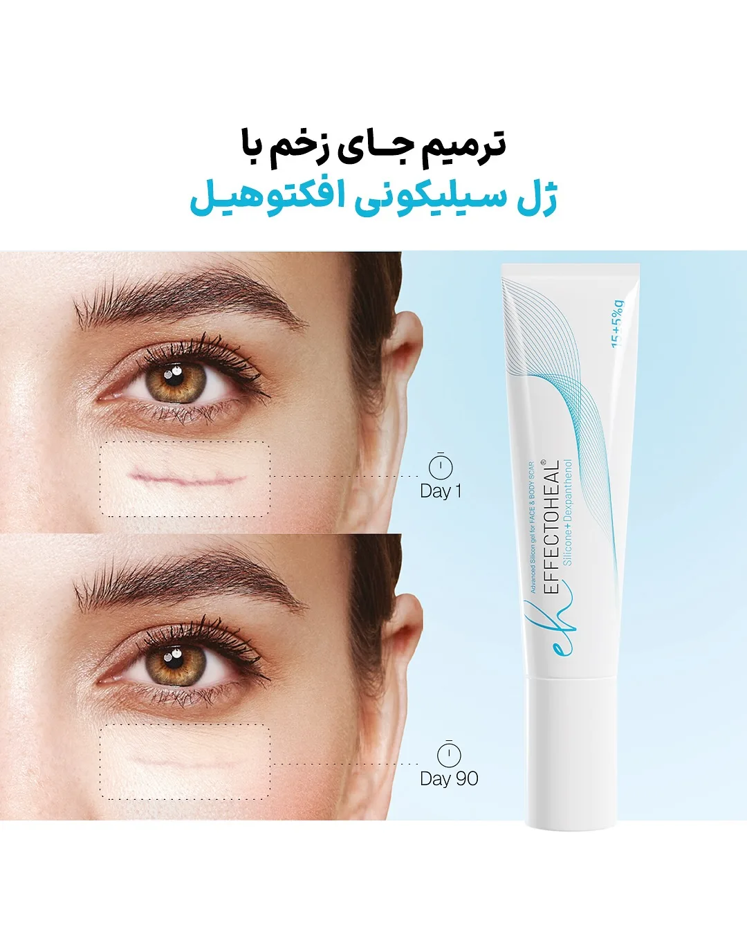 ژل سیلیکونی ترمیم جای زخم و اسکار افکتوهیل، رنگ سفید و آبی، تیوب کرم