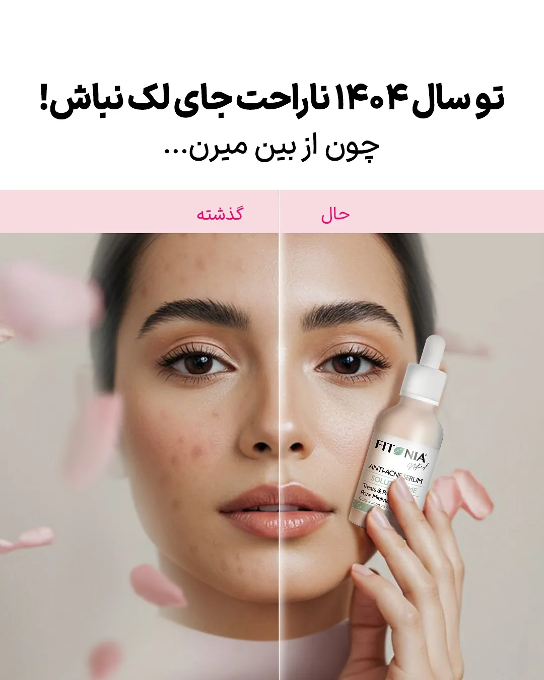 سرم ضدجوش فیتونیا، رنگ کرم و سفید، جنس شیشه، بطری با قطره‌چکان